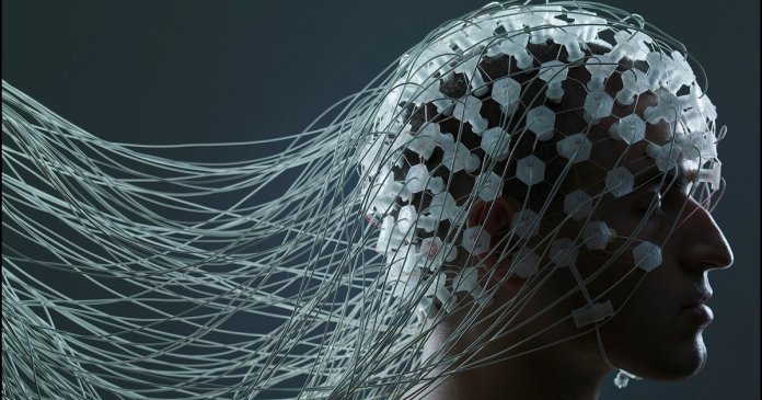 Man with Electrode Wires on Head --- Image by © Adrianna Williams/Corbis