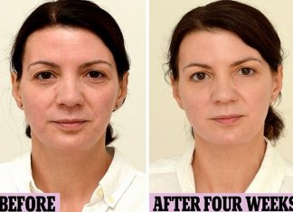 Mulher mostra as mudanças no rosto depois de passar a beber 3 litros de água por dia