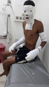 resilienciamag.com - Jovem teve partes do corpo queimados após resgatar 8 cães de um incêndio.