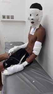 resilienciamag.com - Jovem teve partes do corpo queimados após resgatar 8 cães de um incêndio.