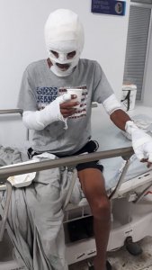 resilienciamag.com - Jovem teve partes do corpo queimados após resgatar 8 cães de um incêndio.