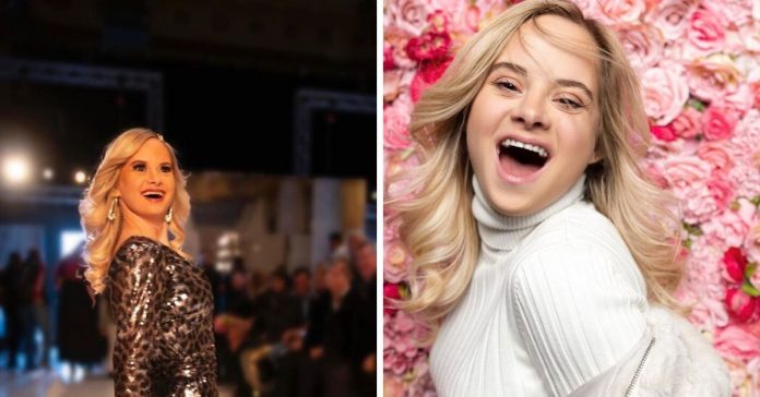 modelo-com-sindrome-de-down-arrasa-na-new-york-fashion-week
