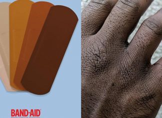 Band-Aid anuncia que fará curativos para diferentes tons de pele