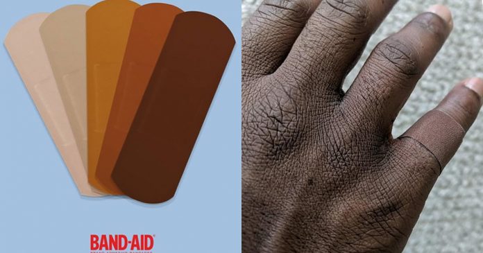 band-aid-anuncia-que-finalmente-fara-curativos-para-diferentes-tons-de-pele band-aid-anuncia-que-finalmente-fara-curativos-para-diferentes-tons-de-pele
