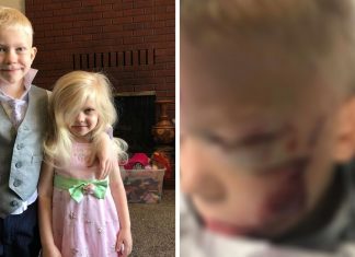 Menino de 6 anos salva irmã de ataque de cão