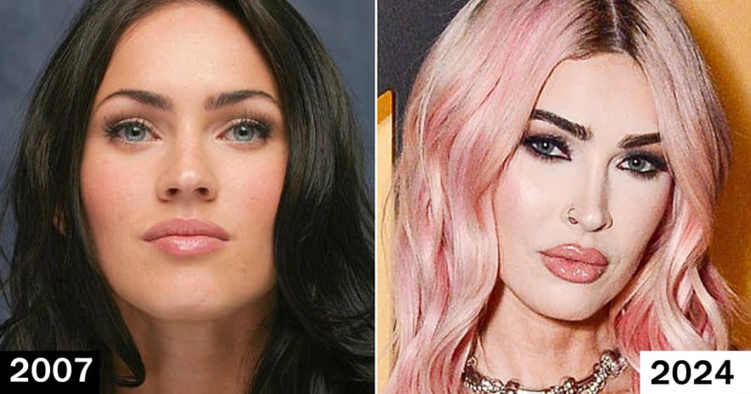 Megan Fox mostra novos lábios no Super Bowl e críticos a comparam com uma ’boneca inflável ucraniana’.