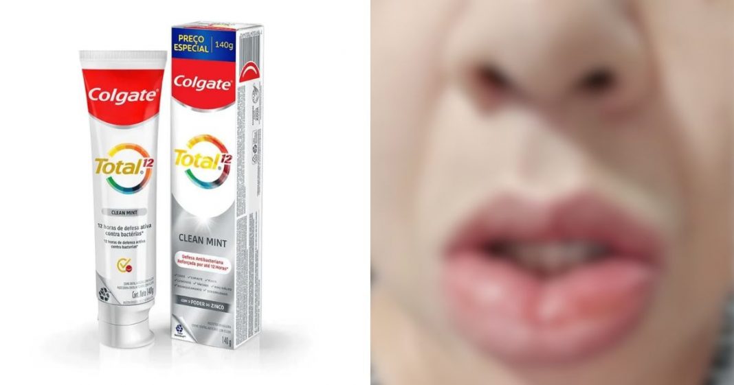Anvisa volta a suspender venda de creme dental da Colgate após novos relatos de reações adversas