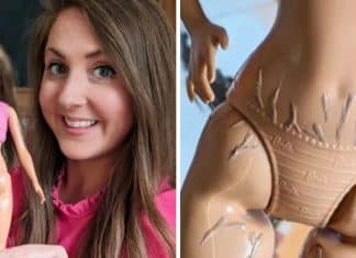 Mãe personaliza boneca com estrias para ensinar autoaceitação e gera debate ‘caloroso’ na internet