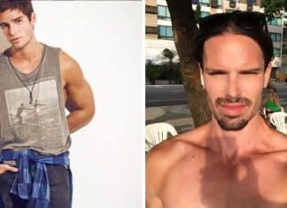 Ex-ator da Globo chama atenção após harmonização facial e vira alvo de piadas na web