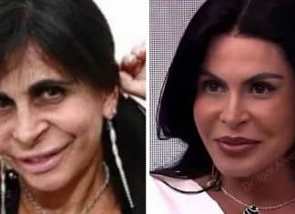 Gretchen surpreende com novo visual após harmonização facial e cirurgia nas pálpebras