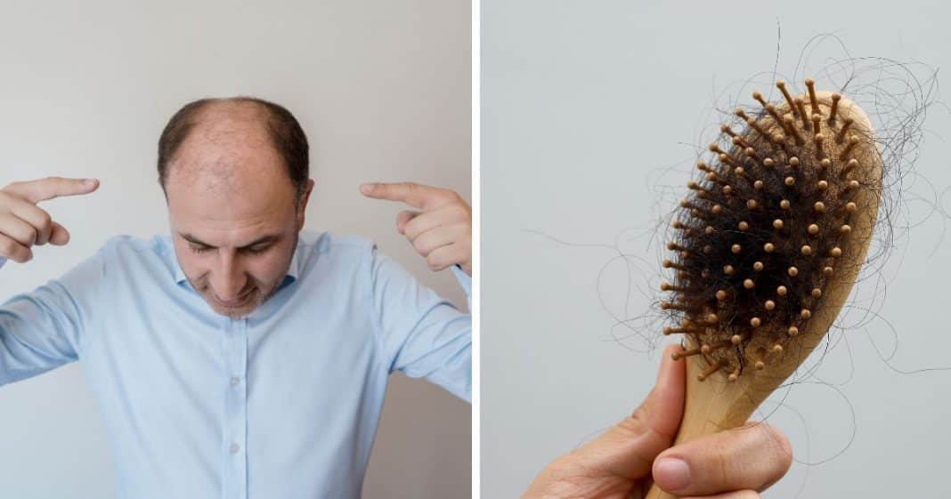 cientistas-descobrem-possivel-cura-para-calvicie-que-faz-cabelo-crescer-em-apenas-20-dias Cientistas descobrem possível “cura” para calvície que faz cabelo crescer em apenas 20 dias