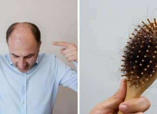 Cientistas descobrem possível “cura” para calvície que faz cabelo crescer em apenas 20 dias