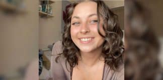 Jovem de 20 anos sofre AVC após único sintoma inesperado — e alerta para sinais que muita gente ignora