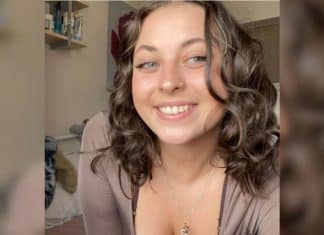 Jovem de 20 anos sofre AVC após único sintoma inesperado — e alerta para sinais que muita gente ignora