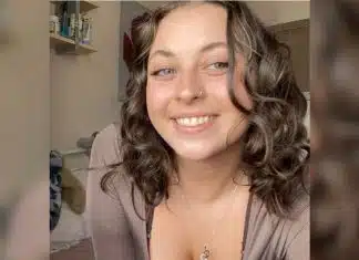 Jovem de 20 anos sofre AVC após único sintoma inesperado — e alerta para sinais que muita gente ignora