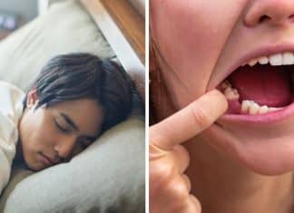 Sonhar com dentes caindo não é por acaso: Entenda o recado do seu subconsciente