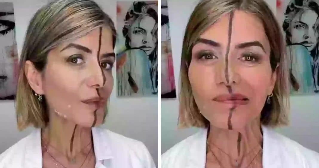 Médica faz teste e aplica botox em só um lado do rosto — o resultado impressionou os internautas