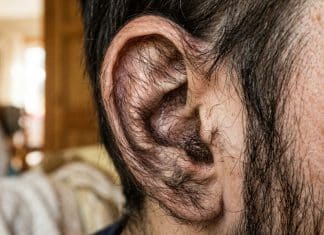 O aparecimento de pelos nas orelhas costuma acontecer por um motivo que muita gente desconhece
